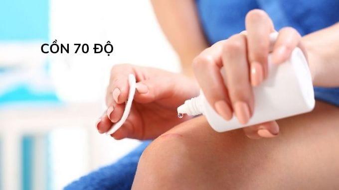 dung dịch rửa vết thương: cồn 70 độ