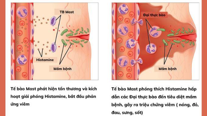 Nhiễm trùng vết mổ: định nghĩa, phân loại, biểu hiện và cách để chăm sóc, phòng ngừa nguyên nhân gây nhiễm trùng vết mổ