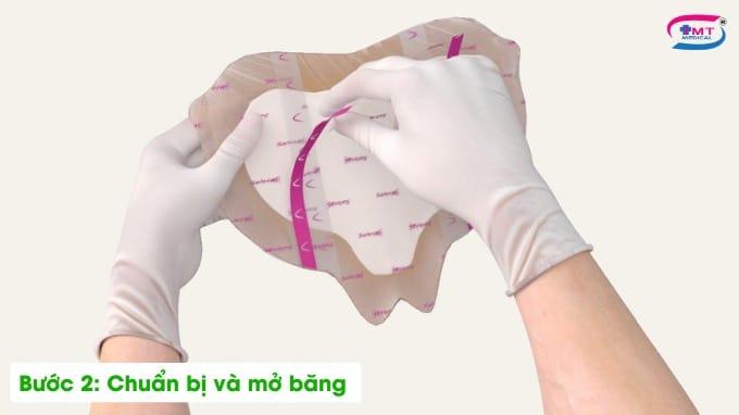 Hướng dẫn sử dụng băng dán vết thương Mepilex Border Sacrum Hướng dẫn sử dụng băng dán vết thương Mepilex Border Sacrum bước 2