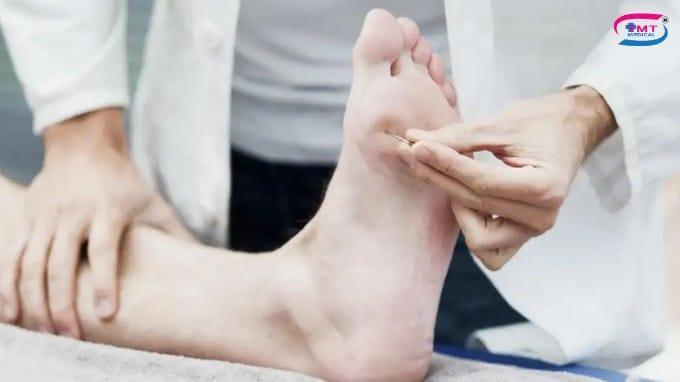 Vết thương lâu lành ở người tiểu đường: nguyên nhân và hướng xử lý Biến chứng nếu không xử lý đúng cách vết thương lâu lành