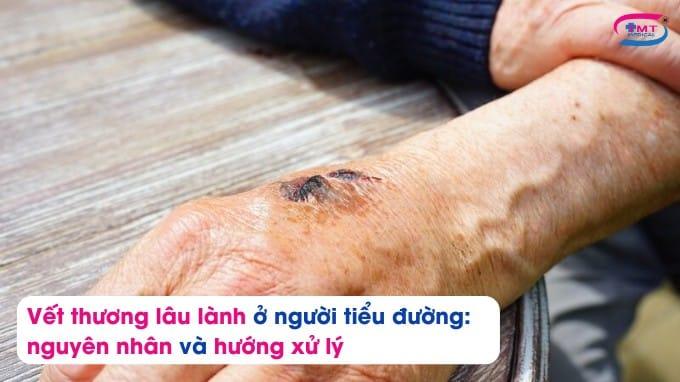 Vết thương lâu lành ở người tiểu đường nguyên nhân và hướng xử lý