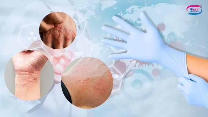 Găng tay không bột có phù hợp với người có làn da nhạy cảm không? 