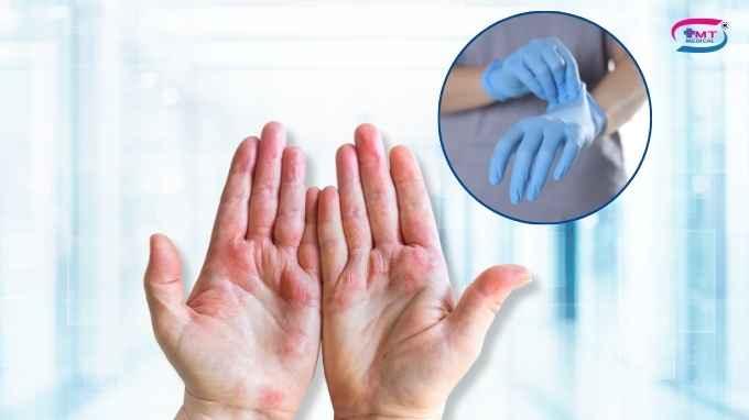 Găng tay latex và nitrile: Khác biệt về vật liệu và nguy cơ kích ứng da găng tay latex và găng tay nitrile