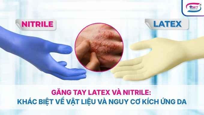 Găng tay latex và nitrile: Khác biệt về vật liệu và nguy cơ kích ứng da